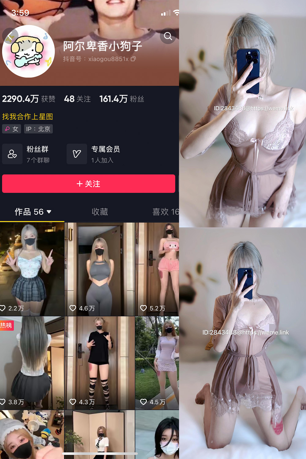 抖音 阿尔卑香小狗子 微密圈  NO.007期 【15P】